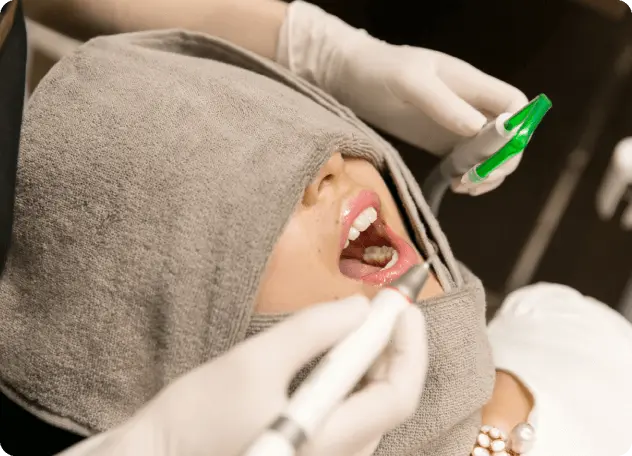 歯石除去